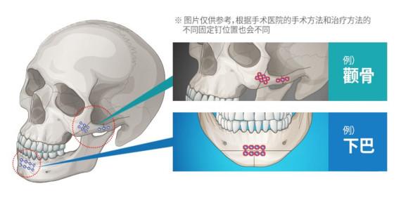 给大家爆料一下X光可以提前知道普通金属暗宝吗《详细教程 新浪科技》